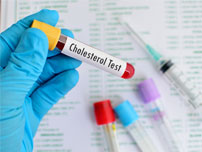 Cholesterol levels are used to predict heart health