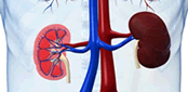 Nephropathy