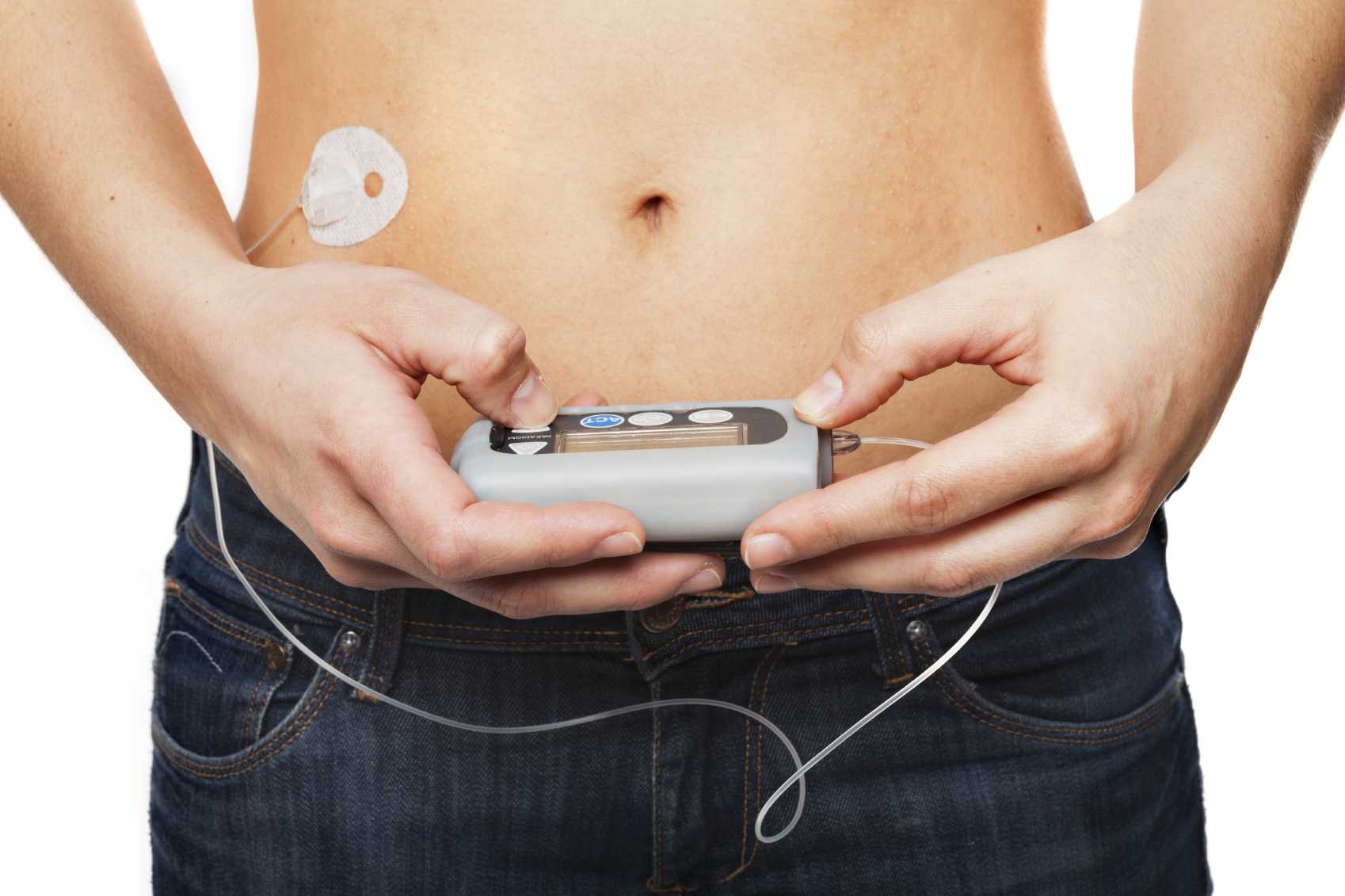 Getting an Insulin Pump