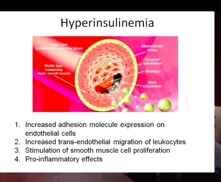 Fung's diagram of cell mechanism with hyperinsulinemia.png