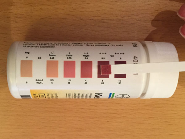 Bayer Ketostix Chart