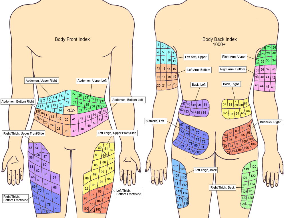 insulin_sites_index2.png