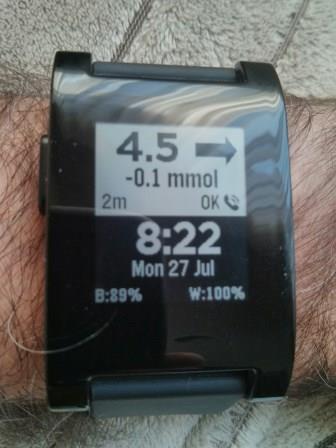 pebble dexcom