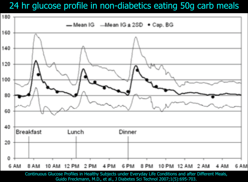 post-29-normal-bg-profile-graph.png