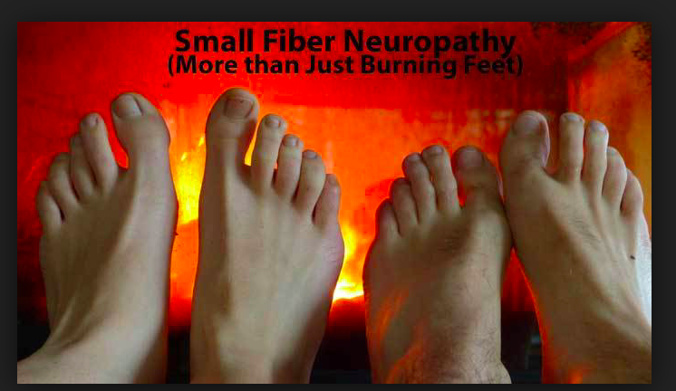 Small fiber neuropathy.png