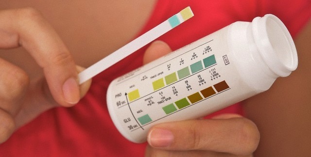 urine-test-result.jpg