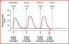 basal bolus profile.JPG
