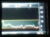 Dexcom 1st Night.jpg
