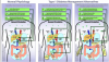 insulin delivery systems.PNG