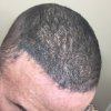 gary-wilkinson-bad-smp-scalpesthetica.JPG
