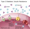 type 2 diabetes insulin resistance diagram.jpg