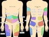 injection sites.png