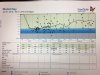 blood sugars of person with diabetes eating carbs.jpg