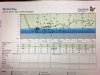 blood sugars of person with diabetes eating carbs.jpg