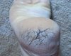 Foot.jpg