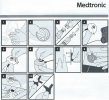 MiniMedQuickSetInstallation.jpg MiniMedQuickSetInstallation.jpg