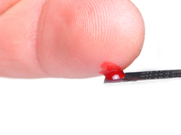 Type 2 diabetes can be tamed by monitoring blood glucose levels, diet and exercise
