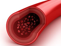 Endothelial dysfunction impairs vasodilation (the widening of blood vessels)