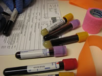 Triglycerides are blood fats that are a flexible source of energy