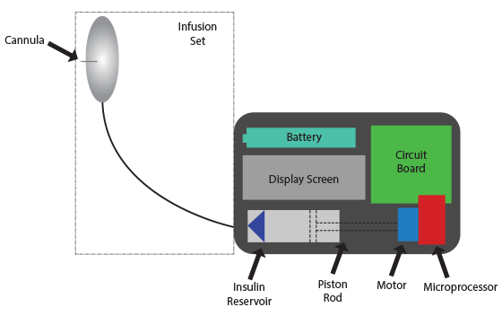Insulin pump diagram