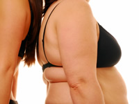Choosing to go private for weight loss surgery is not unusual