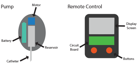 How Insulin Pumps Work