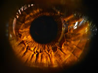 Download 770 Background Retinopathy Paling Keren