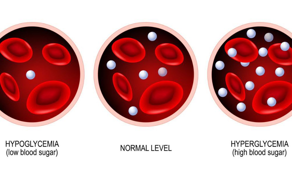The Hidden Dangers Of Hypoglycemia Protect Your Patients Now - 2ebt2vo