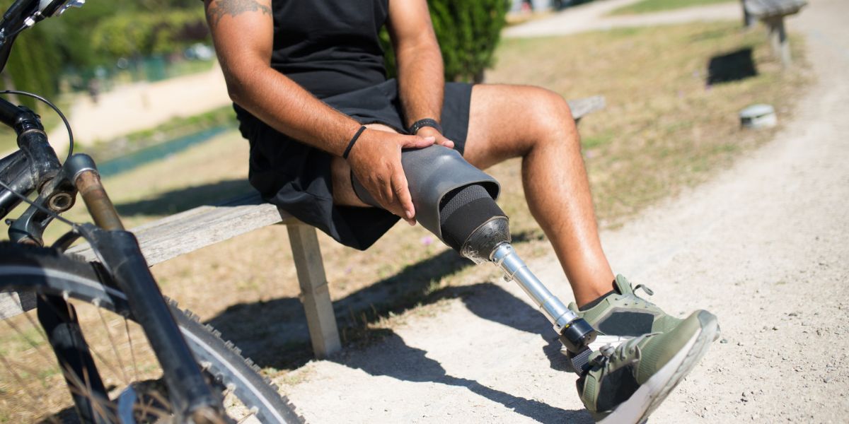 does amputation affect life expectancy