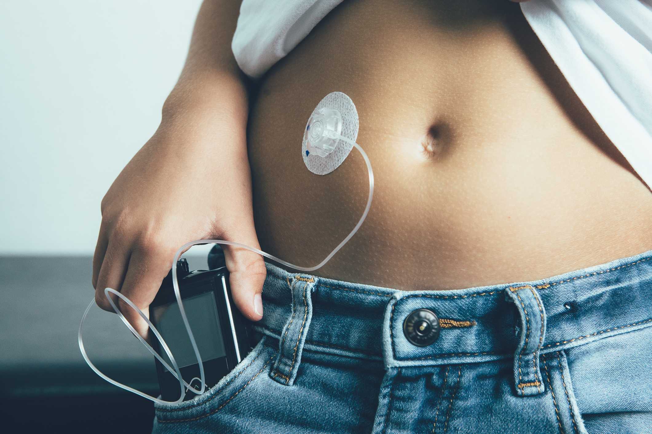 How to Use an Insulin Pump