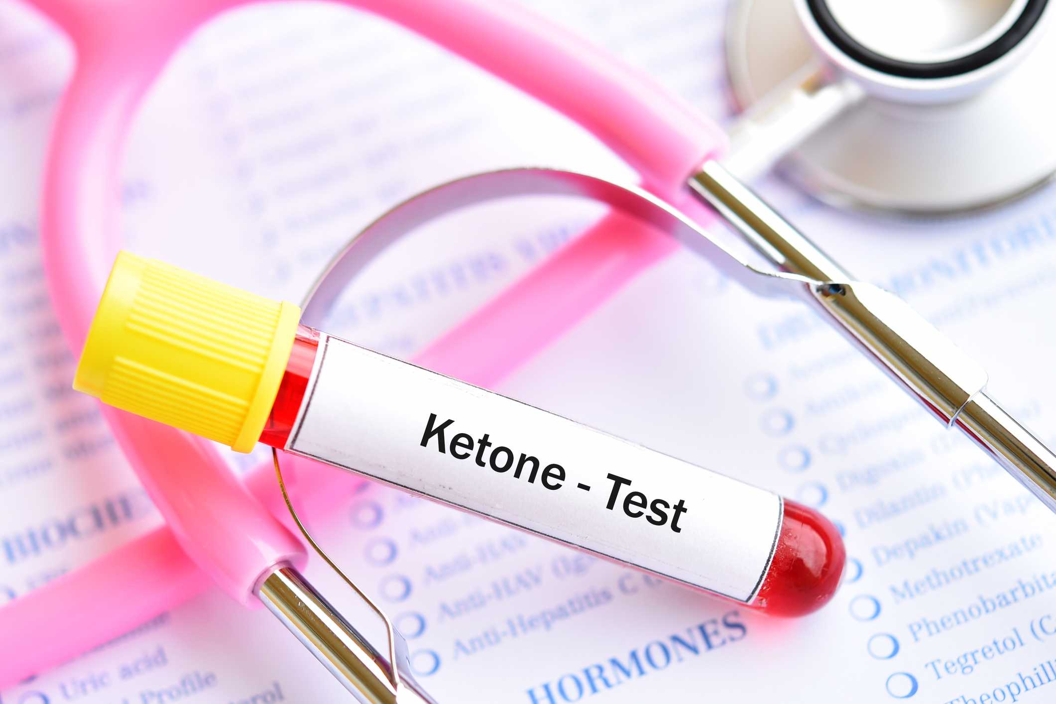 Ketone Levels Chart