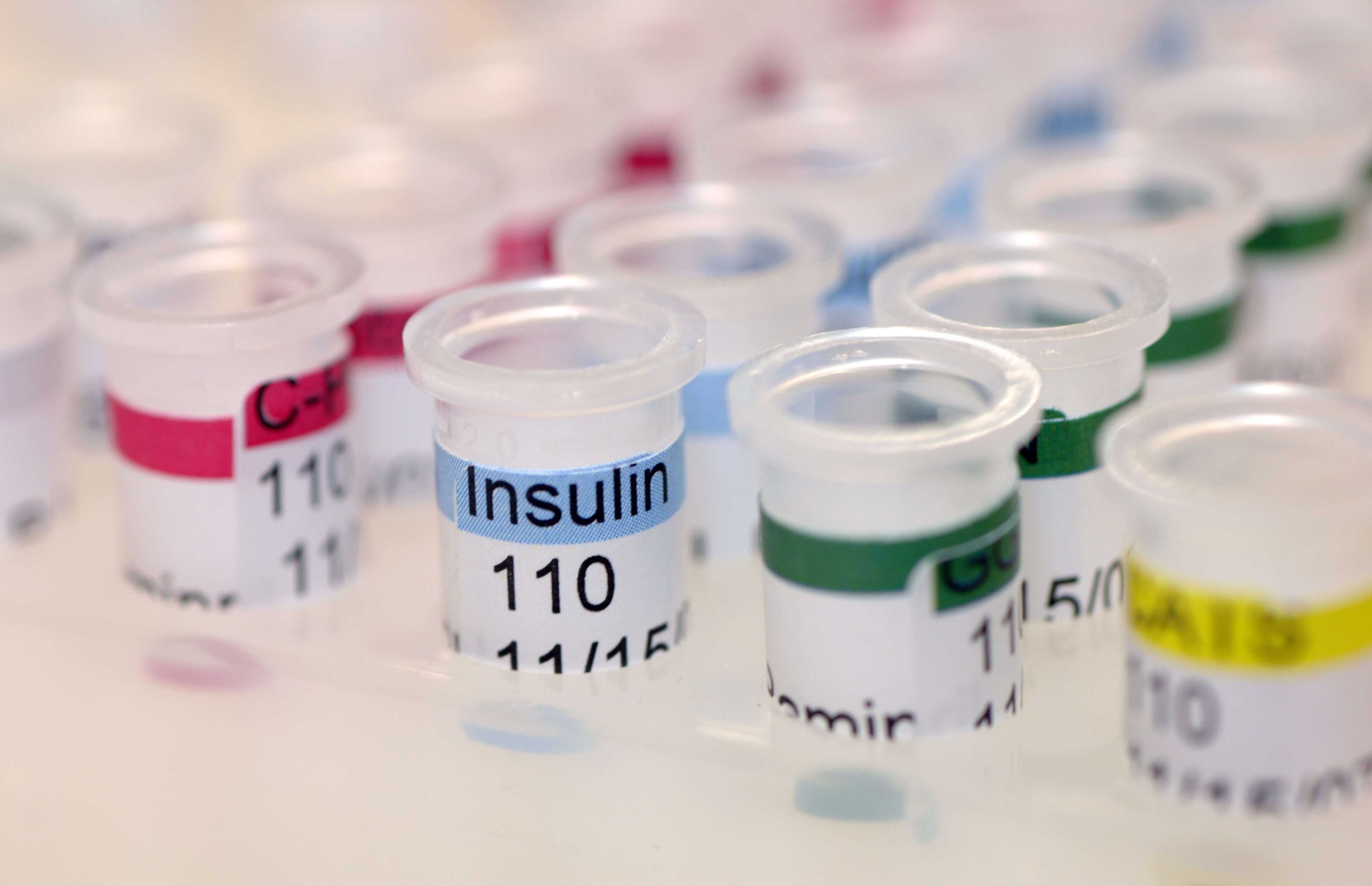 Insulin Injection Site Rotation Chart