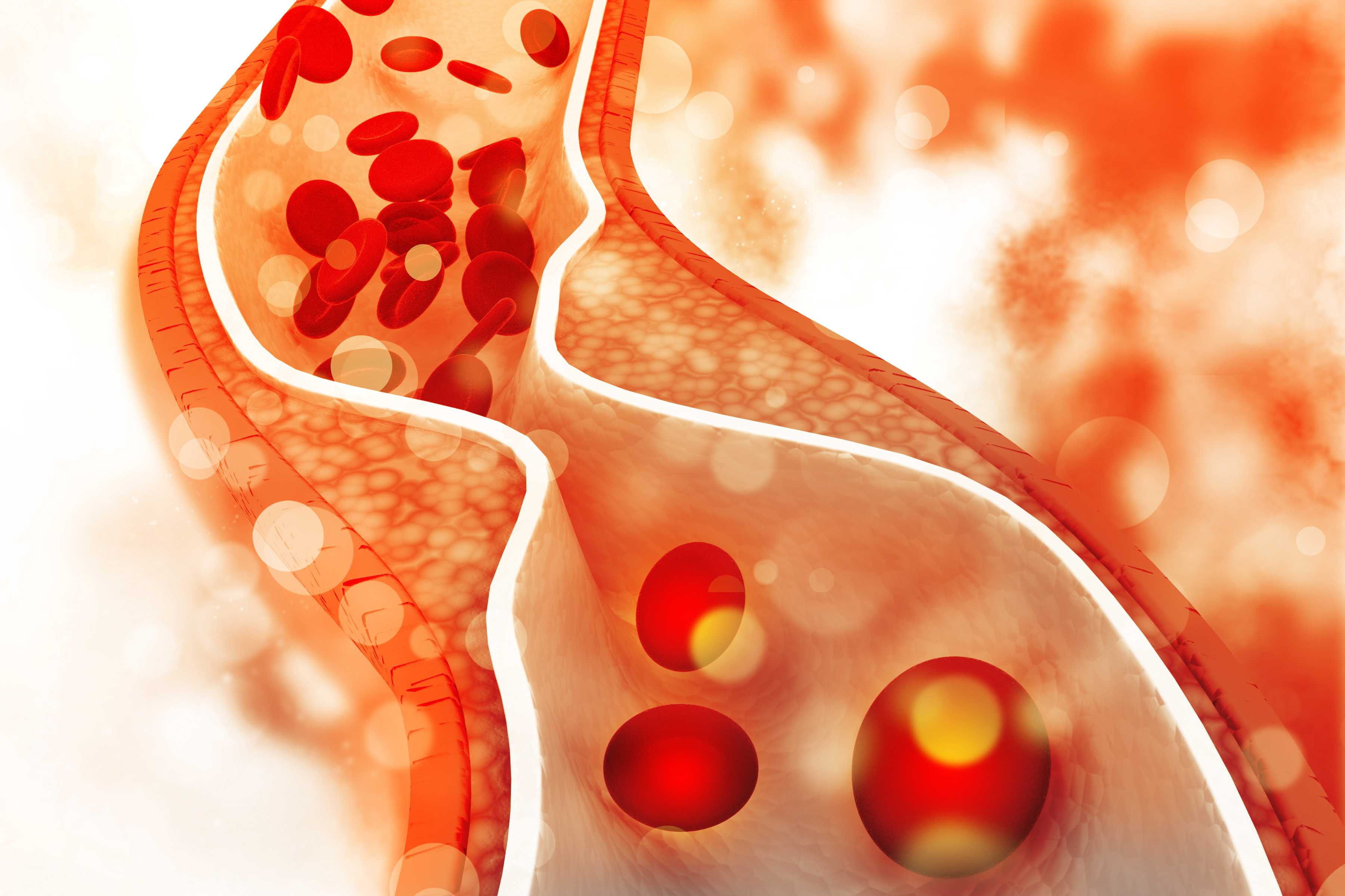 Cholesterol Hdl Ratio Chart