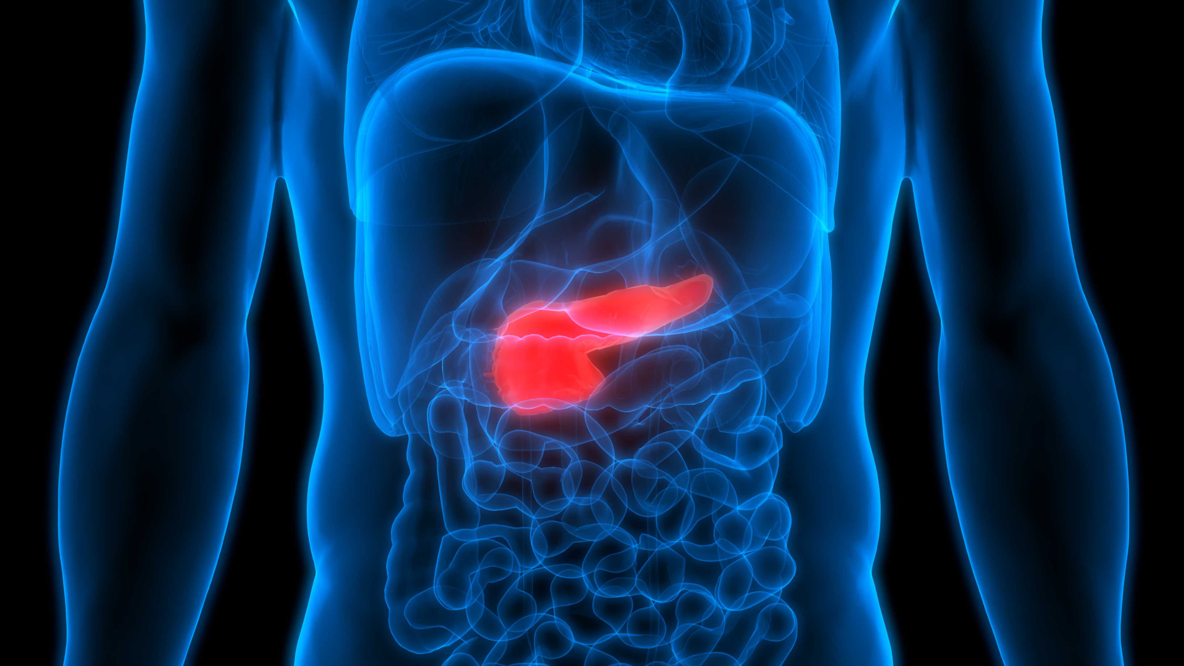 Global Exocrine Pancreatic Insufficiency Market