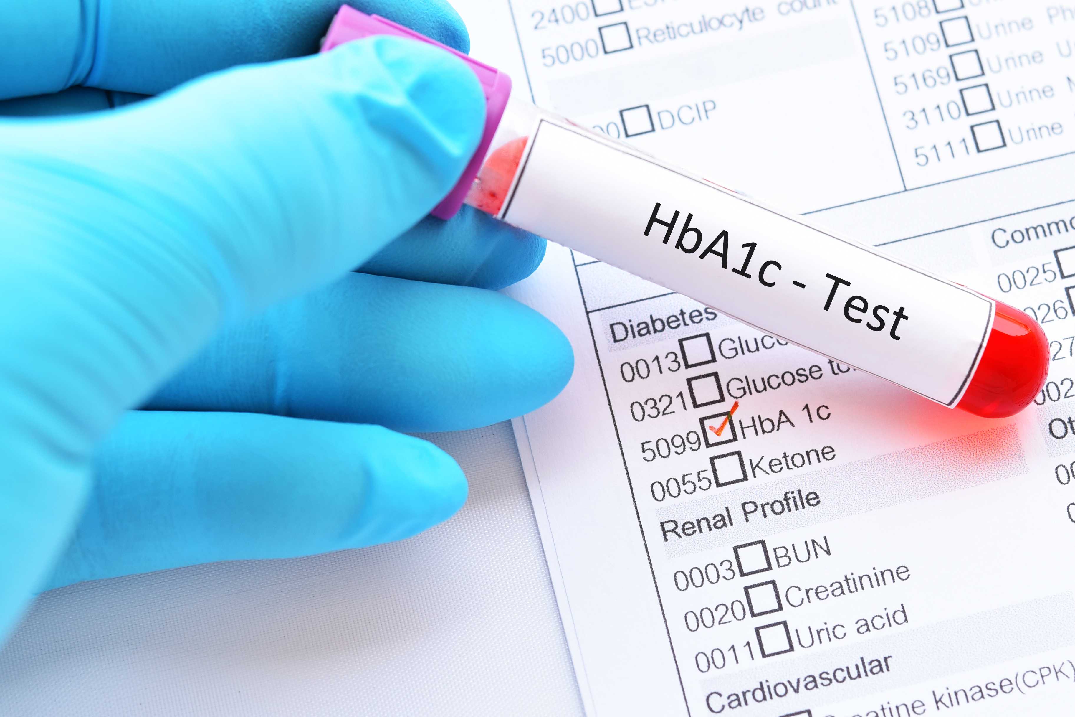 what diet if hgb ac1 6.6?