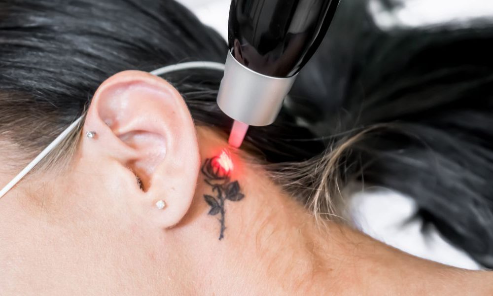 Tattoos and Diabetes - Safety, Risks & Nanotechnology Tattoos Tattoos and Diabetes - Safety, Risks & Nanotechnology Tattoos