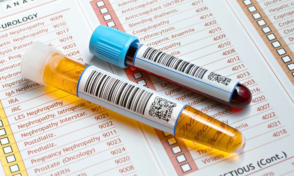 Un Test Sanguin R volutionnaire Pourrait Pr dire Si Les Personnes 