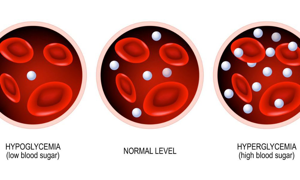 Cual es el nivel normal de glucosa en la sangre