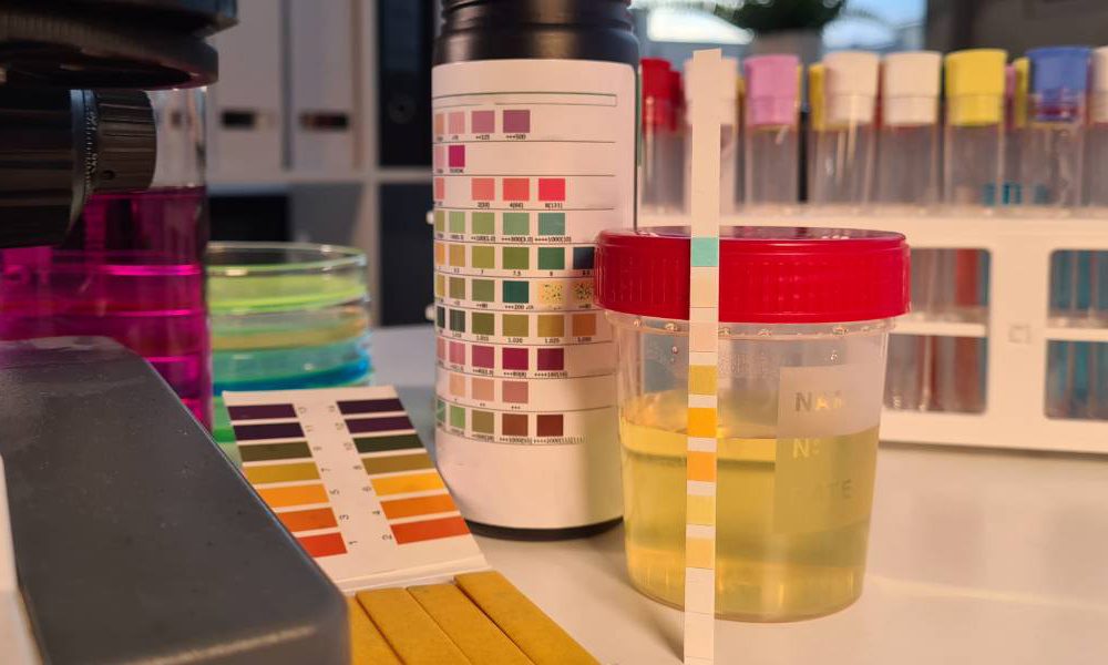 Heart failure risk can be detected in urine